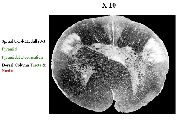 X 10 Spinal Cord-Medulla Jct Pyramidal Decussation Dorsal Column Tracts & Nuclei 