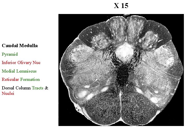 X 15 Caudal Medulla Pyramid Inferior Olivary Nuc Medial Lemniscus Reticular Formation Dorsal Column