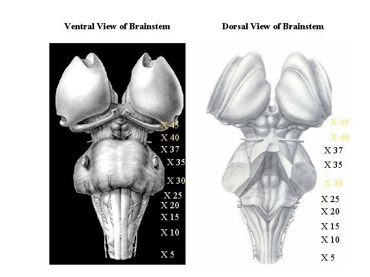 Ventral View of Brainstem X 45 X 40 X 37 X 35 X 30