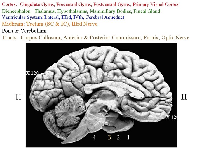 Cortex: Cingulate Gyrus, Precentral Gyrus, Postcentral Gyrus, Primary Visual Cortex Diencephalon: Thalamus, Hypothalamus, Mammillary