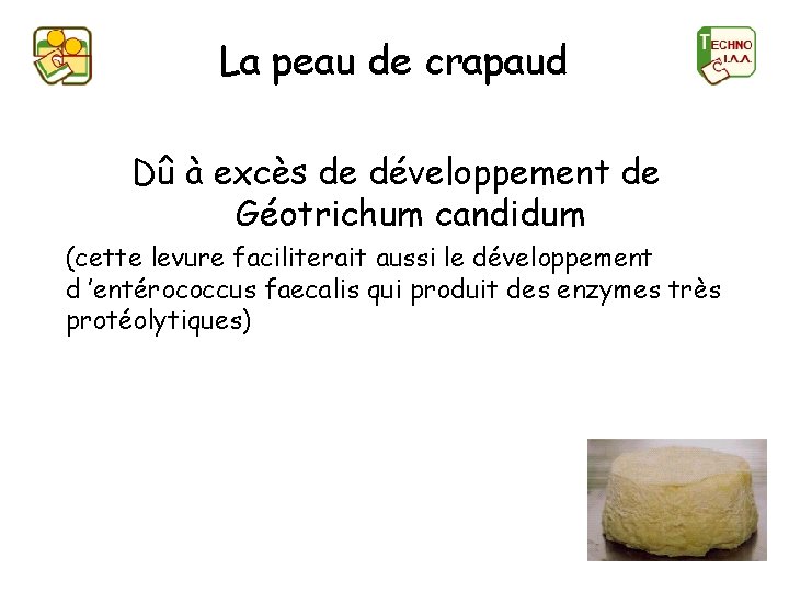 La peau de crapaud Dû à excès de développement de Géotrichum candidum (cette levure