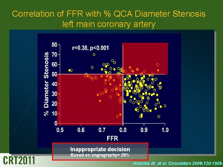 Correlation of FFR with % QCA Diameter Stenosis left main coronary artery Inappropriate decision