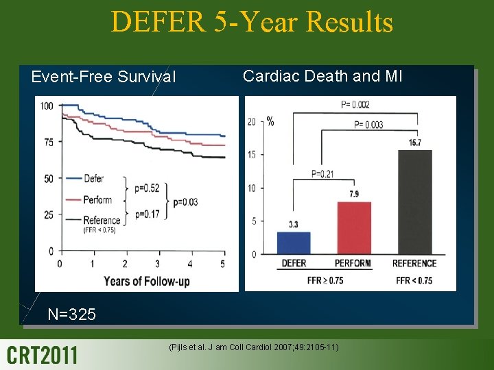 DEFER 5 -Year Results Event-Free Survival Cardiac Death and MI N=325 (Pijls et al.