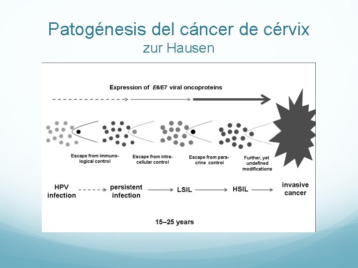 Patogénesis del cáncer de cérvix zur Hausen 