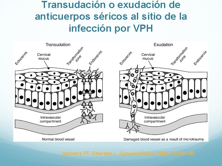 Transudación o exudación de anticuerpos séricos al sitio de la infección por VPH Schwarz