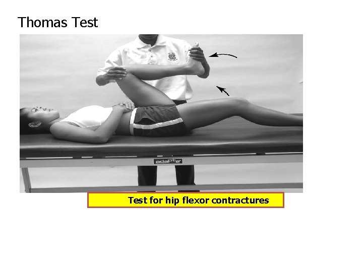 Thomas Test for hip flexor contractures Thomas Test for hip flexor contractures