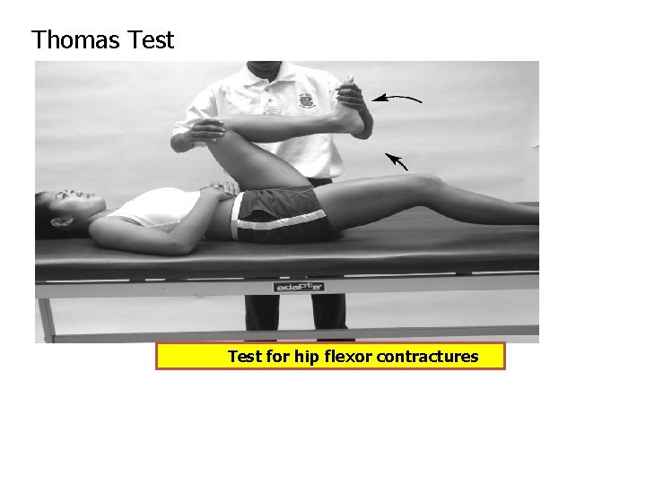 Thomas Test for hip flexor contractures 