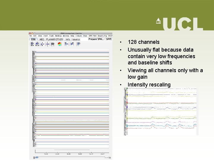 • • 128 channels Unusually flat because data contain very low frequencies and • • 128 channels Unusually flat because data contain very low frequencies and
