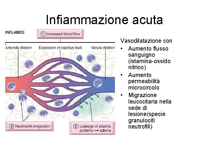 Infiammazione acuta Vasodilatazione con • Aumento flusso sanguigno (istamina-ossido nitrico) • Aumento permeabilità microcircolo