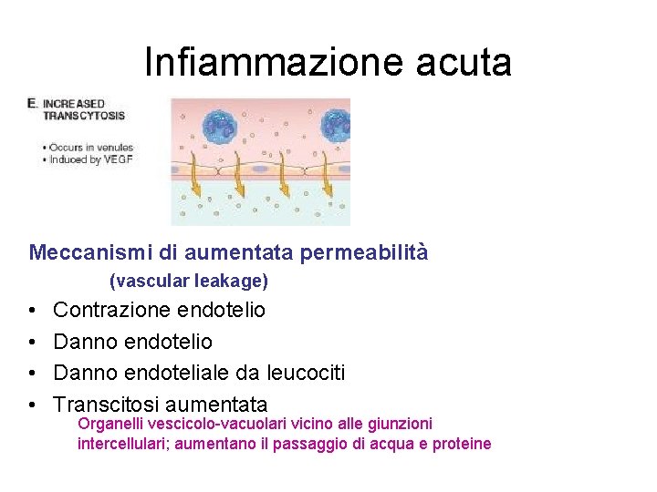 Infiammazione acuta Meccanismi di aumentata permeabilità (vascular leakage) • • Contrazione endotelio Danno endoteliale