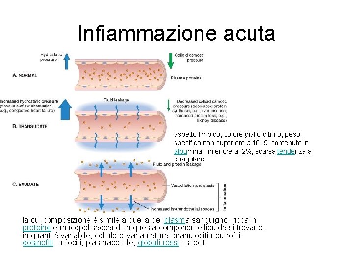 Infiammazione acuta aspetto limpido, colore giallo-citrino, peso specifico non superiore a 1015, contenuto in