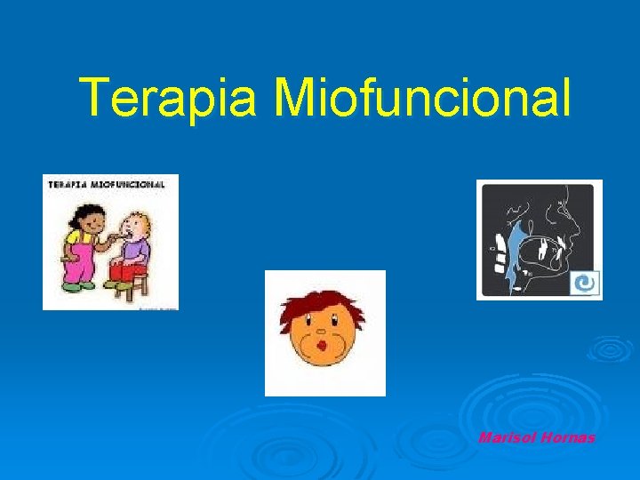 Terapia Miofuncional Marisol Hornas 