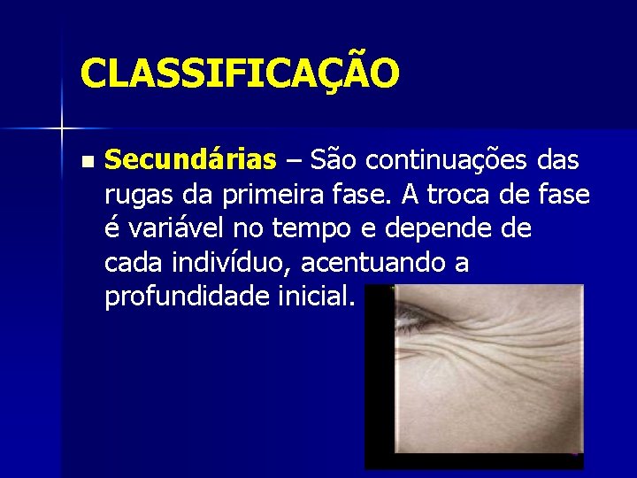 CLASSIFICAÇÃO n Secundárias – São continuações das rugas da primeira fase. A troca de