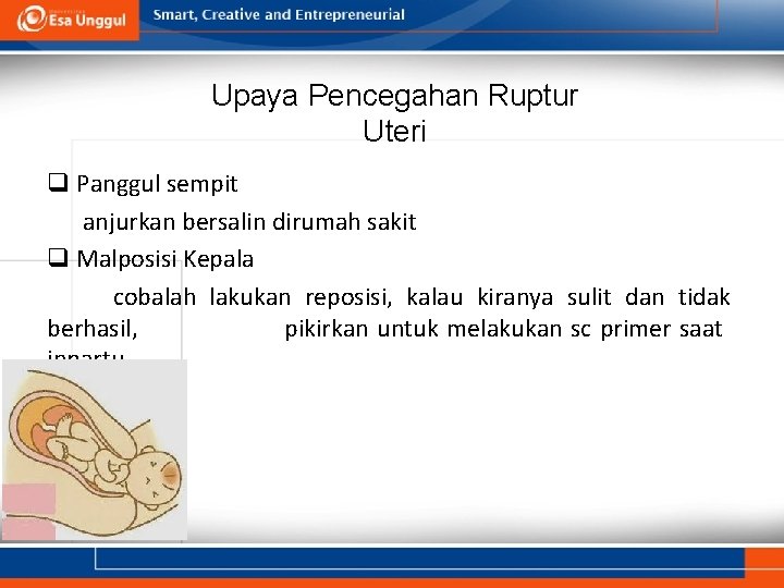 Upaya Pencegahan Ruptur Uteri q Panggul sempit anjurkan bersalin dirumah sakit q Malposisi Kepala Upaya Pencegahan Ruptur Uteri q Panggul sempit anjurkan bersalin dirumah sakit q Malposisi Kepala