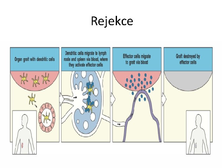 Rejekce 