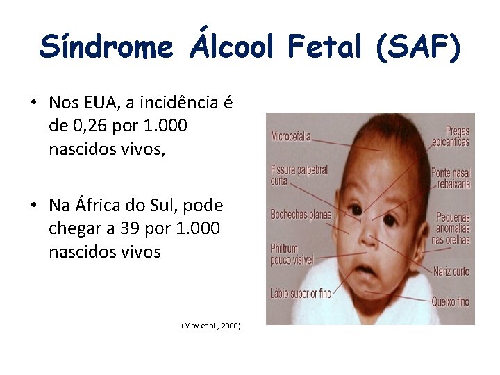 Síndrome Álcool Fetal (SAF) • Nos EUA, a incidência é de 0, 26 por