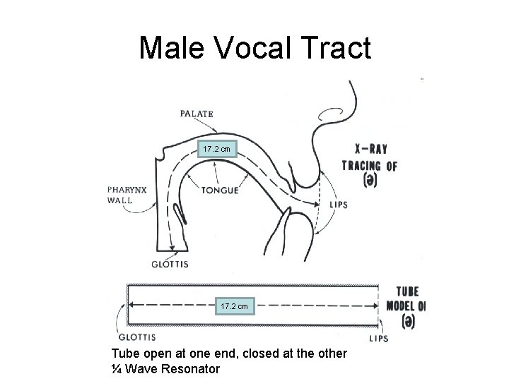 Male Vocal Tract 17. 2 cm Tube open at one end, closed at the