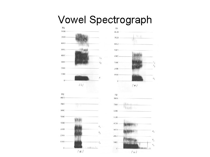 Vowel Spectrograph 