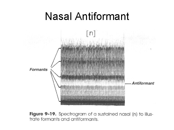 Nasal Antiformant 