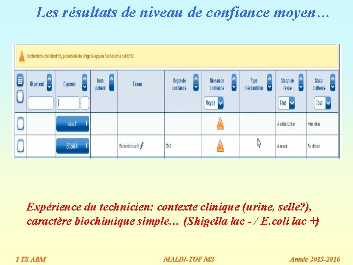 Les résultats de niveau de confiance moyen… Expérience du technicien: contexte clinique (urine, selle? Les résultats de niveau de confiance moyen… Expérience du technicien: contexte clinique (urine, selle?