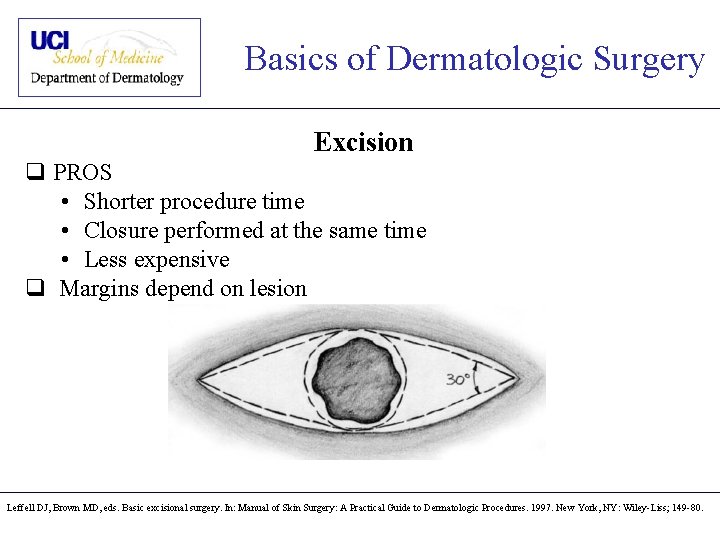 Basics of Dermatologic Surgery Excision q PROS • Shorter procedure time • Closure performed
