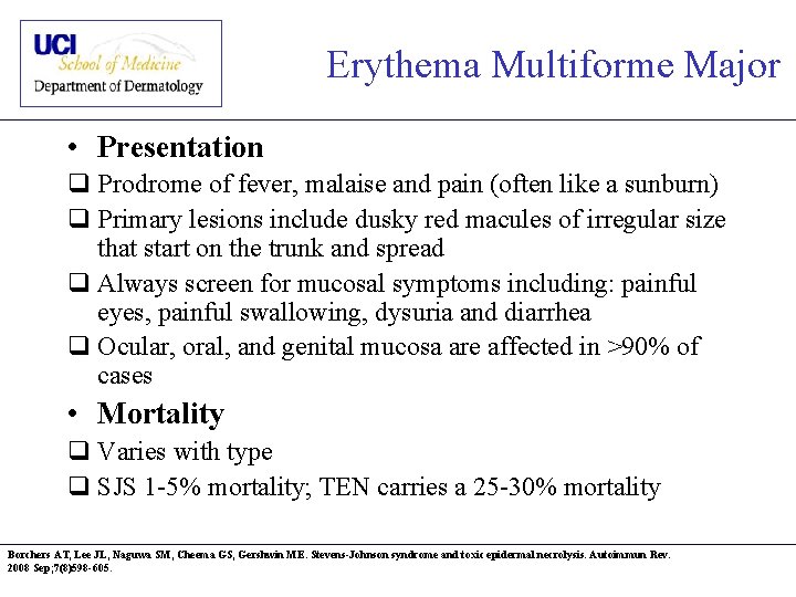 Erythema Multiforme Major • Presentation q Prodrome of fever, malaise and pain (often like
