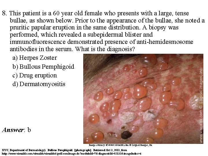 8. This patient is a 60 year old female who presents with a large,