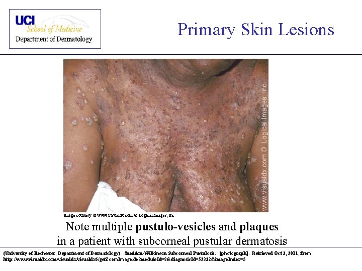 Primary Skin Lesions Image courtesy of www. visualdx. com © Logical Images, Inc Note