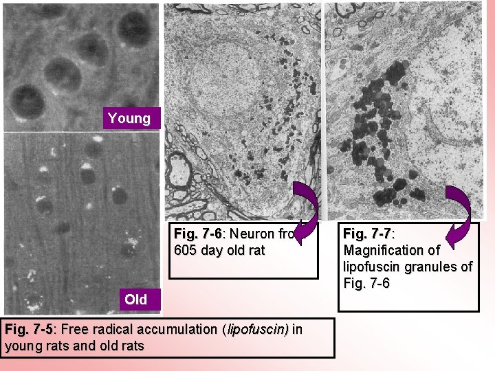Young Fig. 7 -6: Neuron from 605 day old rat Old Fig. 7 -5:
