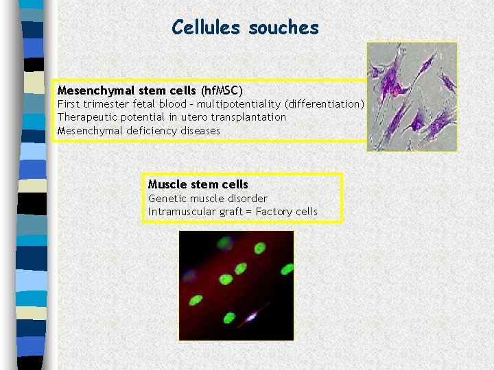 Cellules souches Mesenchymal stem cells (hf. MSC) First trimester fetal blood - multipotentiality (differentiation)