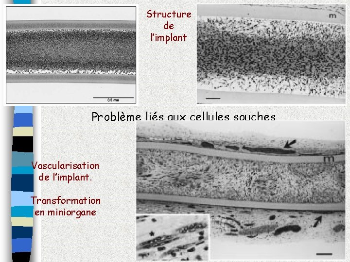 Structure de l’implant Problème liés aux cellules souches Vascularisation de l’implant. Transformation en miniorgane