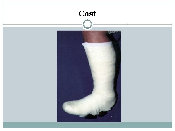 Cast 