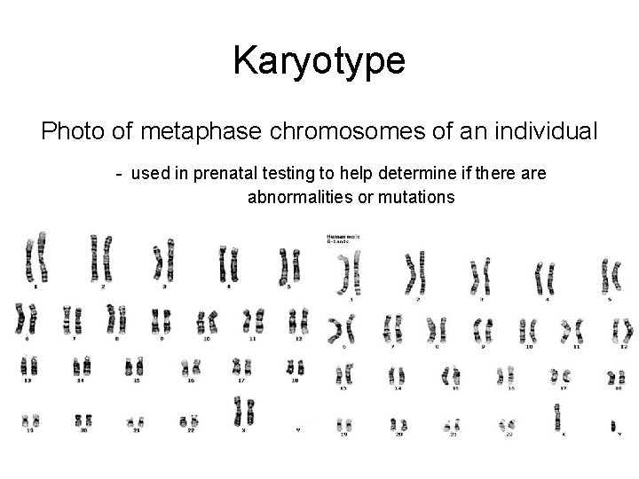 Karyotype Photo of metaphase chromosomes of an individual - used in prenatal testing to