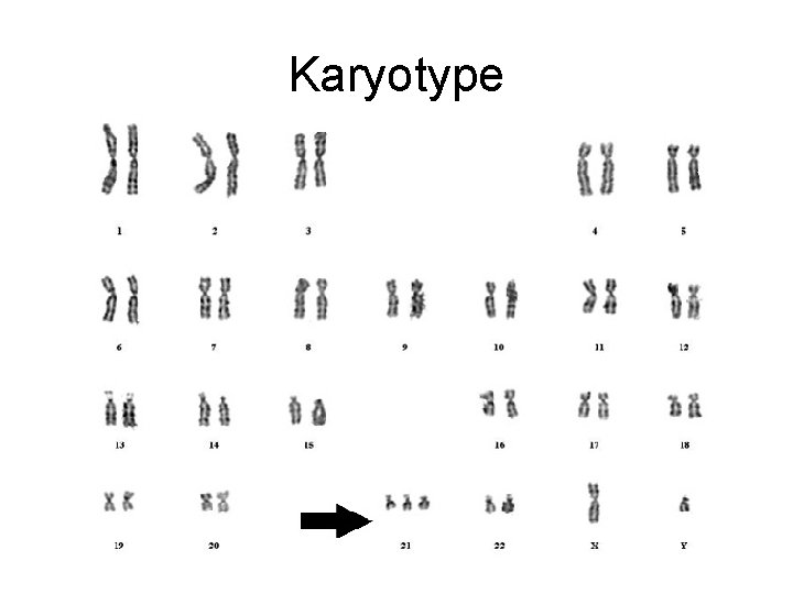 Karyotype 