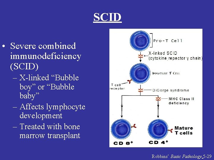 SCID • Severe combined immunodeficiency (SCID) – X-linked “Bubble boy” or “Bubble baby” –