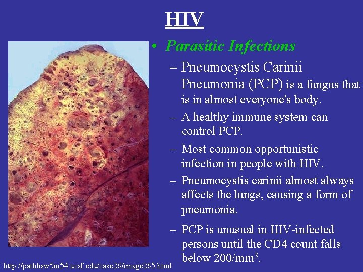 HIV • Parasitic Infections – Pneumocystis Carinii Pneumonia (PCP) is a fungus that is