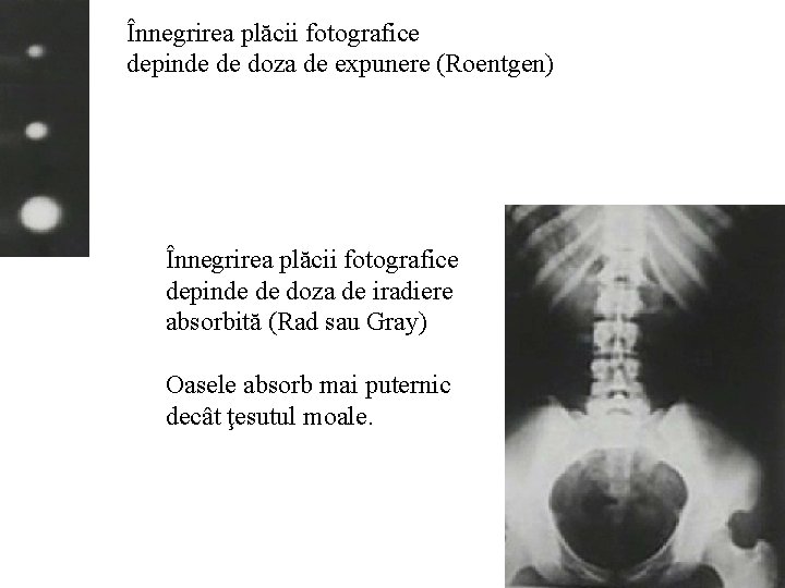 Înnegrirea plăcii fotografice depinde de doza de expunere (Roentgen) Înnegrirea plăcii fotografice depinde de Înnegrirea plăcii fotografice depinde de doza de expunere (Roentgen) Înnegrirea plăcii fotografice depinde de