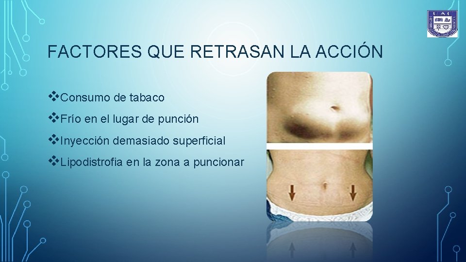 FACTORES QUE RETRASAN LA ACCIÓN v. Consumo de tabaco v. Frío en el lugar