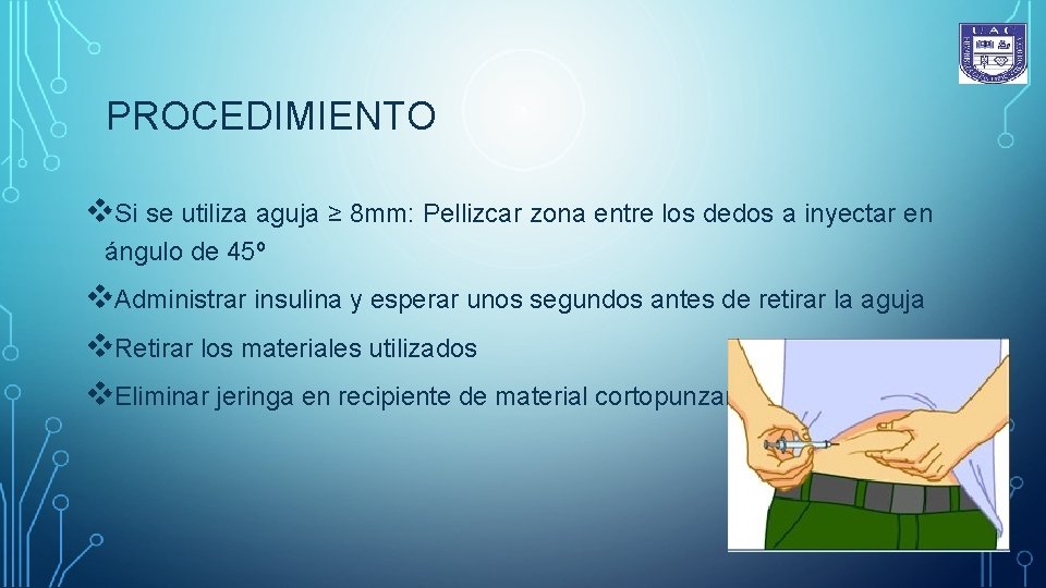 PROCEDIMIENTO v. Si se utiliza aguja ≥ 8 mm: Pellizcar zona entre los dedos