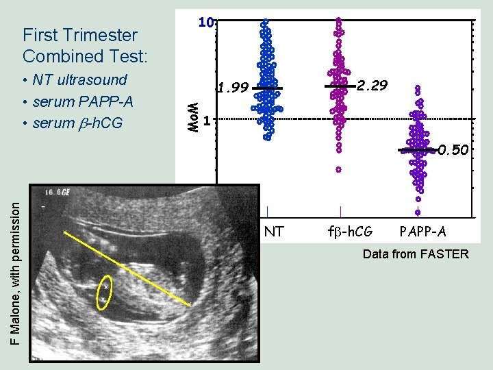 • NT ultrasound • serum PAPP-A • serum b-h. CG 2. 29 1. • NT ultrasound • serum PAPP-A • serum b-h. CG 2. 29 1.