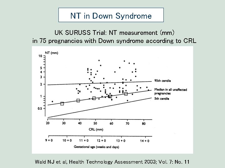 NT in Down Syndrome UK SURUSS Trial: NT measurement (mm) in 75 pregnancies with NT in Down Syndrome UK SURUSS Trial: NT measurement (mm) in 75 pregnancies with
