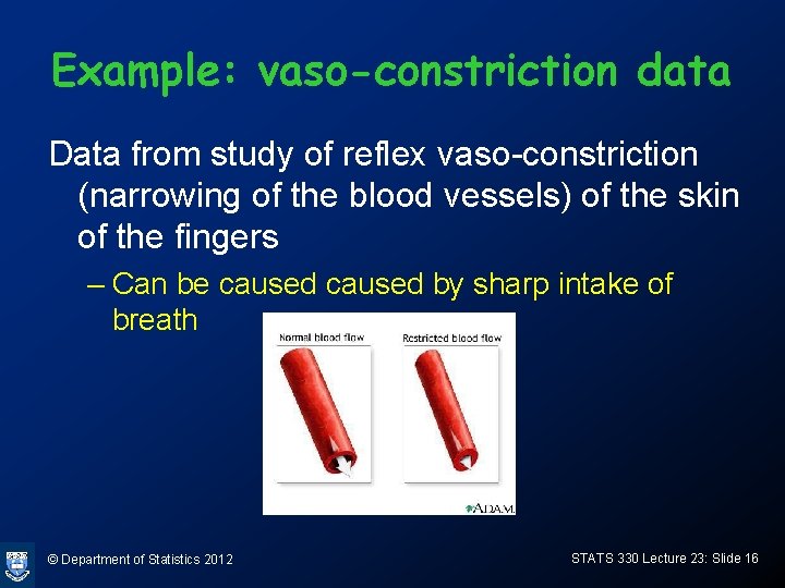 Example: vaso-constriction data Data from study of reflex vaso-constriction (narrowing of the blood vessels)