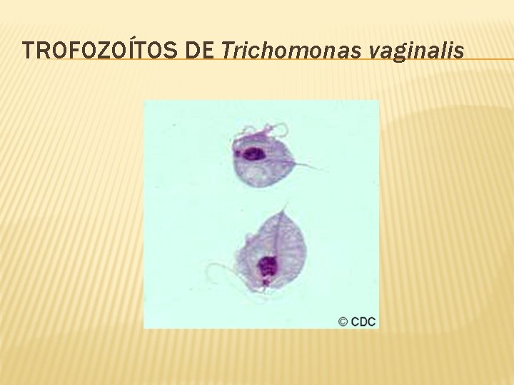 TROFOZOÍTOS DE Trichomonas vaginalis 