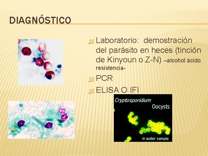 DIAGNÓSTICO Laboratorio: demostración del parásito en heces (tinción de Kinyoun o Z-N) –alcohol ácido