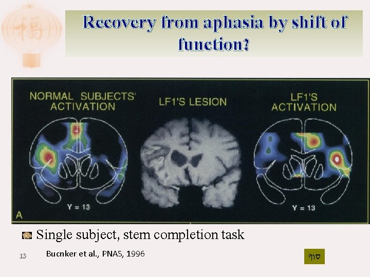 Recovery from aphasia by shift of function? Single subject, stem completion task 13 Bucnker