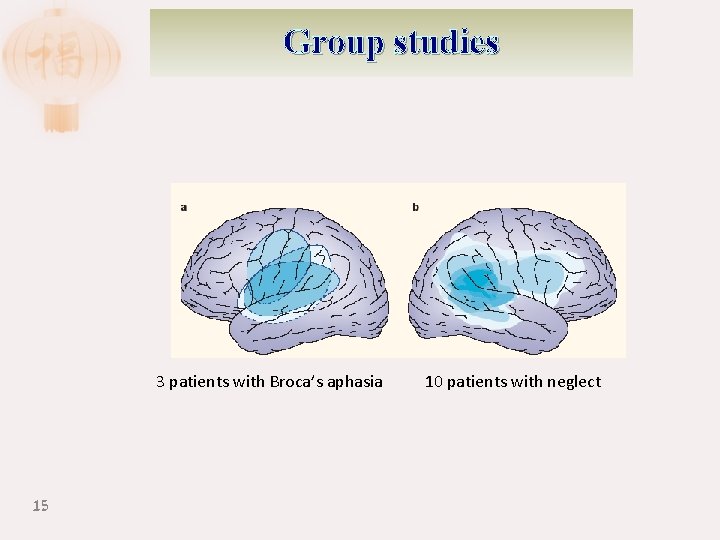 Group studies 3 patients with Broca’s aphasia 15 10 patients with neglect 