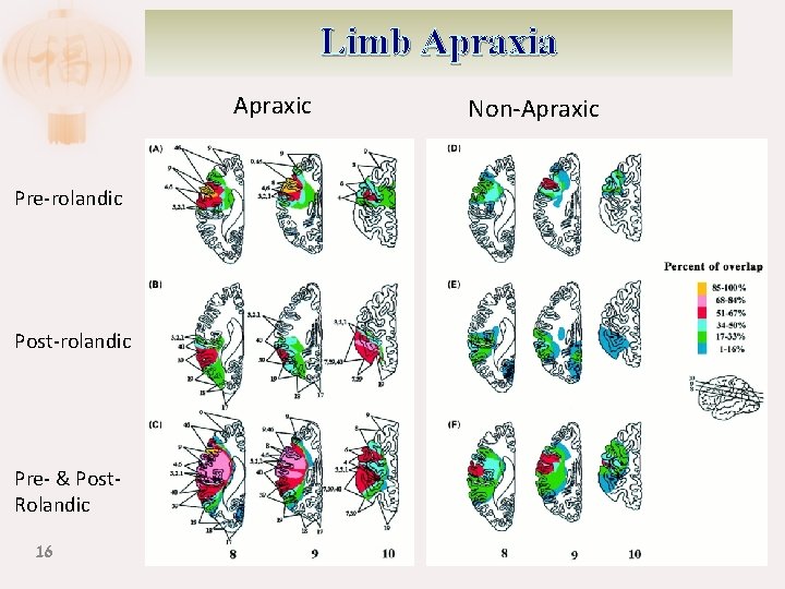 Limb Apraxia Apraxic Pre-rolandic Post-rolandic Pre- & Post. Rolandic 16 Non-Apraxic 