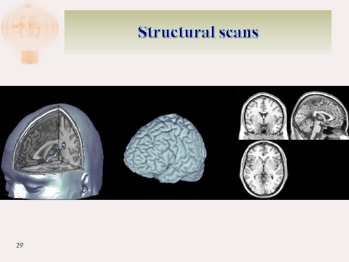 Structural scans 29 