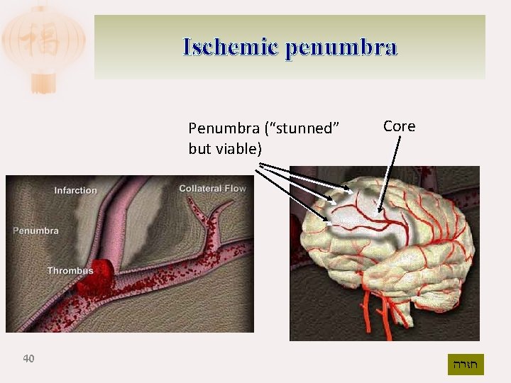 Ischemic penumbra Penumbra (“stunned” but viable) 40 Core חזרה 