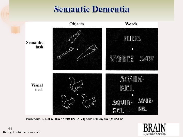Semantic Dementia Illustration of tasks performed by subjects during scanning Mummery, C. J. et